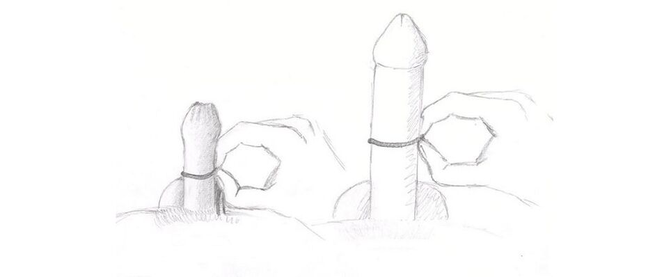measurement of penis thickness